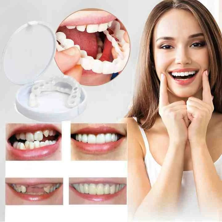 CARILLAS DENTALES - Snap-On Smile®